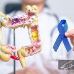 نقش ژنتیک در سرطان روده بزرگ؛ از پیشگیری تا تشخیص زودهنگام