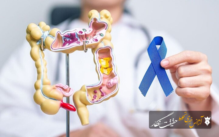 نقش ژنتیک در سرطان روده بزرگ؛ از پیشگیری تا تشخیص زودهنگام نقش ژنتیک در سرطان روده بزرگ؛ از پیشگیری تا تشخیص زودهنگام