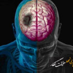 یک متخصص: هر دقیقه تأخیر در درمان سکته مغزی به نابودی ۱.۹ میلیون سلول عصبی منجر می‌شود